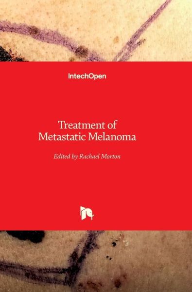 Cover for Rachael Morton · Treatment of Metastatic Melanoma (Hardcover Book) (2011)