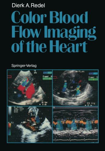 Cover for Dierk A. Redel · Color Blood Flow Imaging of the Heart (Paperback Book) [Softcover reprint of the original 1st ed. 1988 edition] (2011)