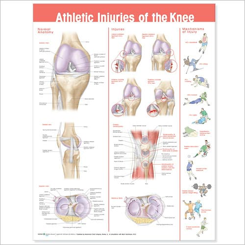 Cover for Acc · Athletic Injuries of the Knee Anatomical Chart (Landkarten) (2009)