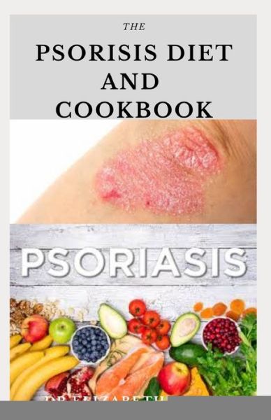 Cover for Dr Elizabeth David · The Psoriasis Diet and Cookbook (Paperback Book) (2020)