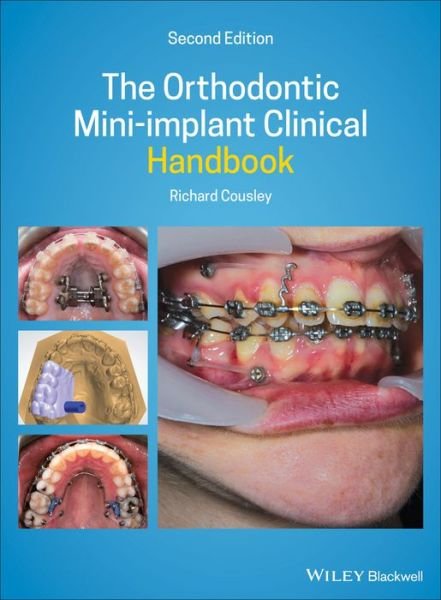 Cover for Cousley, Richard (Consultant Orthodontist for the Peterborough &amp; Stamford Hospitals NHS Foundation Trust) · The Orthodontic Mini-implant Clinical Handbook (Hardcover Book) (2020)