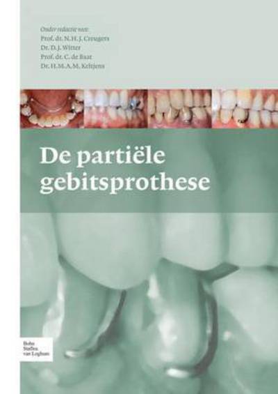 De Partiele Gebitsprothese: Uitgangspunten Bij De Diagnostiek en Behandeling Van Het Gemutileerde Gebit - N H J Creugers - Livros - Bohn Stafleu Van Loghum - 9789031375752 - 20 de dezembro de 2011