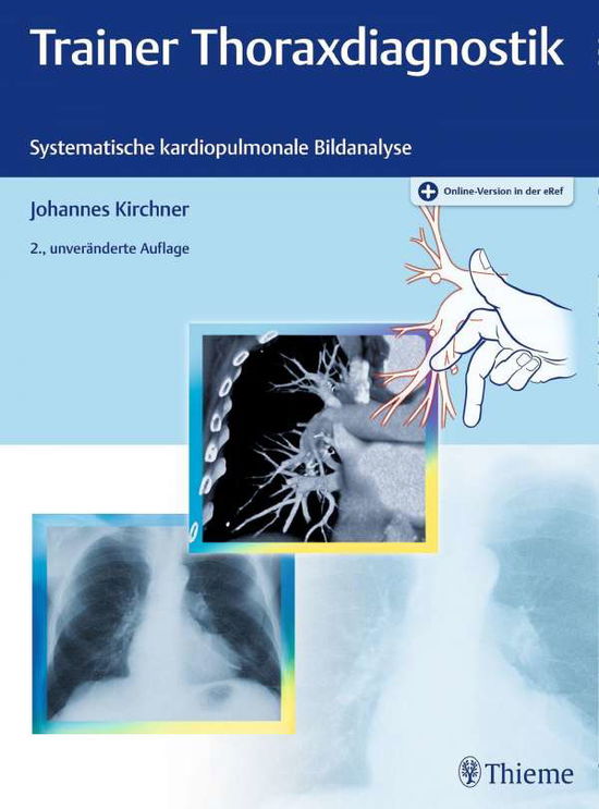 Trainer Thoraxdiagnostik - Kirchner - Książki -  - 9783132424753 - 