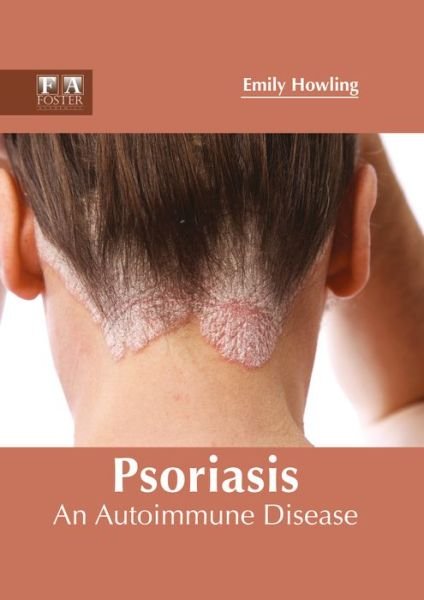 Cover for Emily Howling · Psoriasis: An Autoimmune Disease (Hardcover Book) (2017)