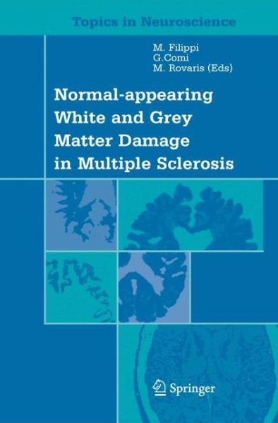 Normal-appearing White and Grey Matter Damage in Multiple Sclerosis - Topics in Neuroscience - M Filippi - Książki - Springer Verlag - 9788847021754 - 2 listopada 2012