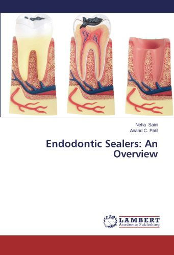 Cover for Anand C. Patil · Endodontic Sealers: an Overview (Paperback Book) (2014)