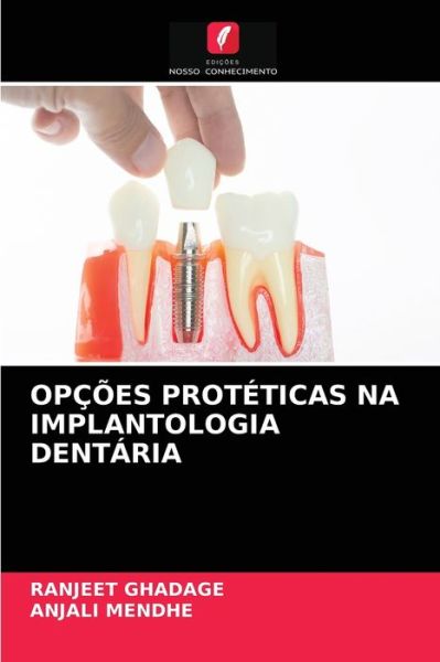 Cover for Ranjeet Ghadage · Opcoes Proteticas Na Implantologia Dentaria (Paperback Book) (2021)