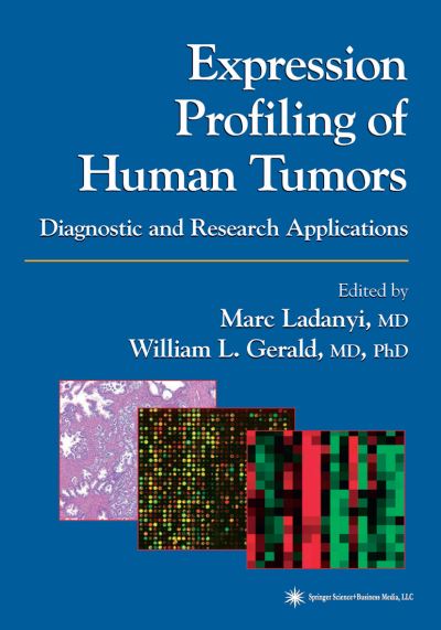 Cover for Expression Profiling of Human Tumors: Diagnostic and Research Applications (Paperback Book) [Softcover reprint of the original 1st ed. 2003 edition] (2010)