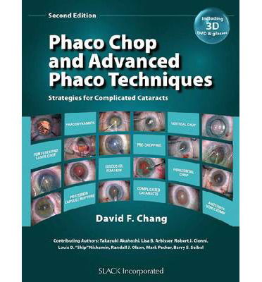 Phaco Chop and Advanced Phaco Techniques: Strategies for Complicated Cataracts - David F. Chang - Books - Taylor & Francis Inc - 9781617110757 - April 15, 2013