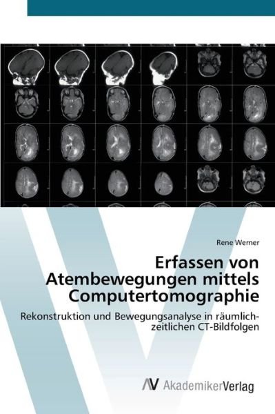 Cover for Werner · Erfassen von Atembewegungen mitt (Bog) (2012)