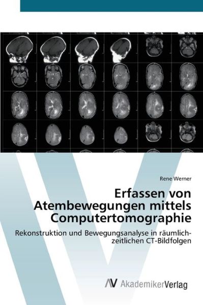 Cover for Werner · Erfassen von Atembewegungen mitt (Book) (2012)