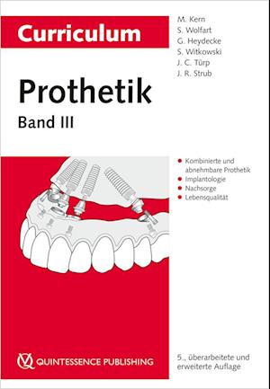 Curriculum Prothetik Band 3 - Matthias Kern - Books - Quintessenz Verlags-GmbH - 9783868675757 - March 29, 2022