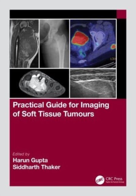 Cover for Harun Gupta · Practical Guide for Imaging of Soft Tissue Tumours (Paperback Book) (2023)