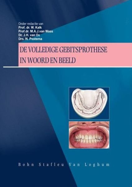De volledige gebitsprothese in woord en beeld: Uitgangspunten voor diagnostiek en behandeling van de edentate patient - W. Kalk - Boeken - Bohn Stafleu van Loghum - 9789031321759 - 15 september 2004