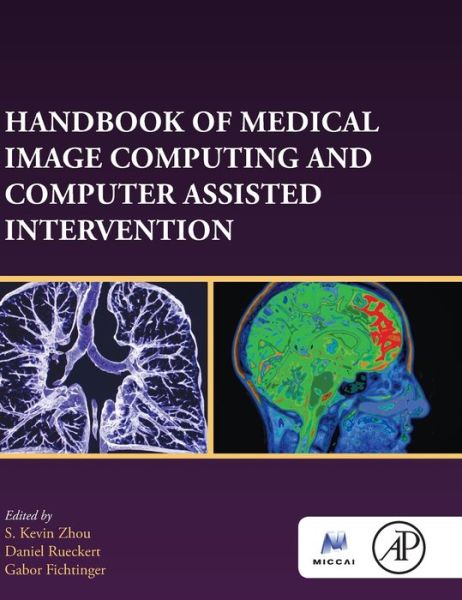 Cover for Handbook of Medical Image Computing and Computer Assisted Intervention - The MICCAI Society book Series (Hardcover Book) (2019)