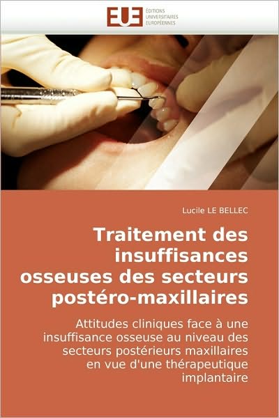 Cover for Lucile Le Bellec · Traitement Des Insuffisances Osseuses Des Secteurs Postéro-maxillaires: Attitudes Cliniques Face À Une Insuffisance Osseuse Au Niveau Des Secteurs ... Thérapeutique Implantaire (Paperback Book) [French edition] (2010)