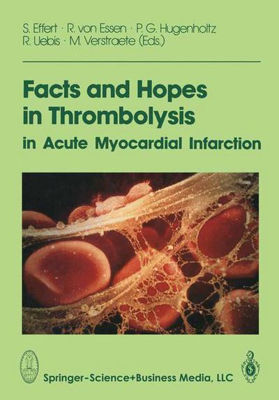 Facts and Hopes in Thrombolysis in Acute Myocardial Infarction - S Effert - Bøger - Steinkopff Darmstadt - 9783662071762 - 3. oktober 2013