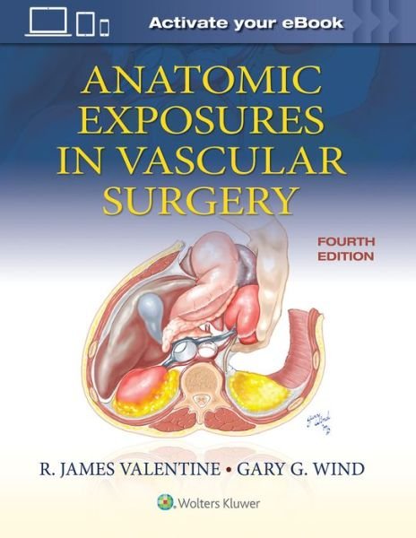 Cover for R. James Valentine · Anatomic Exposures in Vascular Surgery (Hardcover Book) (2020)