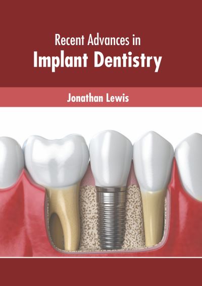 Cover for Jonathan Lewis · Recent Advances in Implant Dentistry (Hardcover Book) (2022)