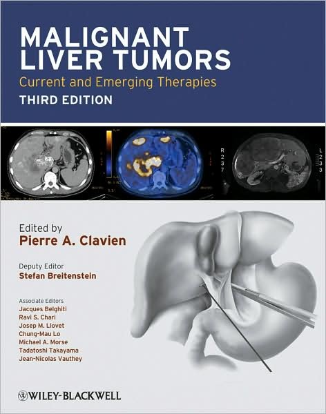 Cover for PA Clavien · Malignant Liver Tumors: Current and Emerging Therapies (Hardcover Book) (2010)