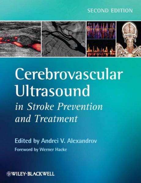 Cover for A Alexandrov · Cerebrovascular Ultrasound in Stroke Prevention and Treatment (Hardcover Book) (2011)