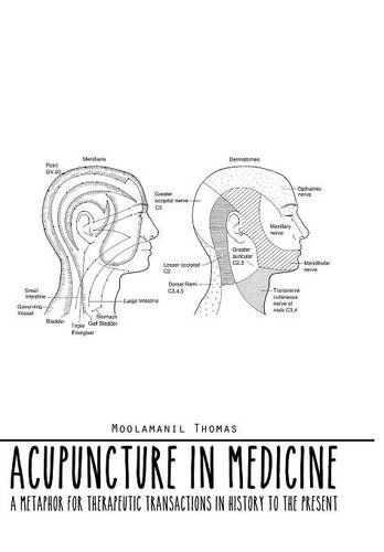 Cover for Moolamanil Thomas · Acupuncture in Medicine: a Metaphor for Therapeutic Transactions in History to the Present (Hardcover Book) (2014)