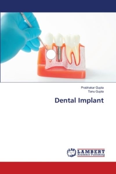 Cover for Gupta · Dental Implant (Buch) (2020)