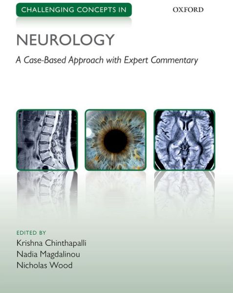 Cover for Krishna Chinthapalli · Challenging Concepts in Neurology: Cases with Expert Commentary - Challenging Cases (Paperback Book) (2016)