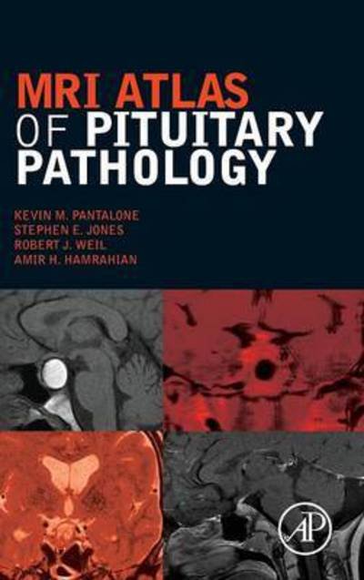 Cover for Pantalone, Kevin M. (Associate Staff Clinician, Department of Endocrinology, Diabetes and Metabolism, Cleveland Clinic Foundation, Cleveland, OH, USA) · MRI Atlas of Pituitary Pathology (Hardcover Book) (2015)