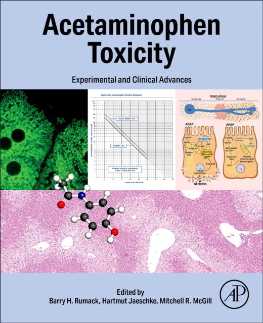 Acetaminophen Toxicity: Experimental and Clinical Advances (Taschenbuch) (2024)