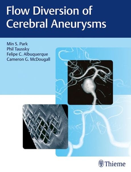 Flow Diversion of Cerebral Aneurysms - Min S. Park - Boeken - Thieme Medical Publishers Inc - 9781626237773 - 25 oktober 2017