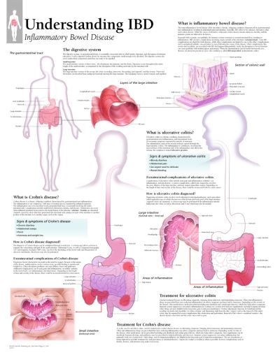 Cover for Scientific Publishing · Understanding IBD (Plakat) (2020)