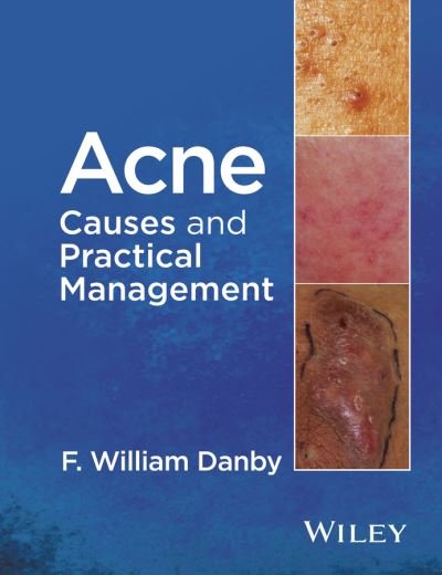 Cover for Danby, F. William (Department of Dermatology, Geisel School of Medicine at Dartmouth, NH, USA) · Acne: Causes and Practical Management (Hardcover Book) (2015)