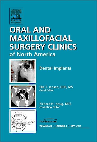 Cover for Ole Jensen · Dental Implants, an Issue of Oral and Maxillofacial Surgery (Gebundenes Buch) (2011)