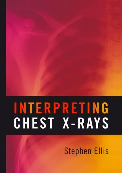 Interpreting Chest X-Rays - Stephen Ellis - Books - Scion Publishing Ltd - 9781904842774 - April 13, 2010