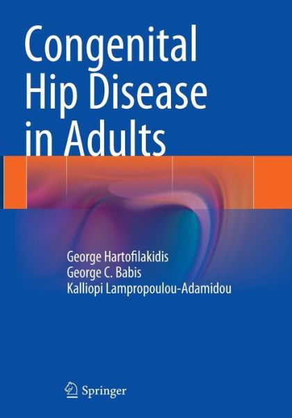 Cover for George Hartofilakidis · Congenital Hip Disease in Adults (Pocketbok) [Softcover reprint of the original 1st ed. 2014 edition] (2016)