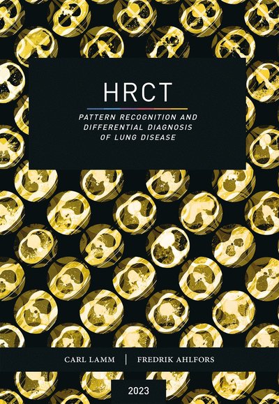 Cover for Carl Lamm · HRCT : pattern recognition and differential diagnosis of lung disease (Book) (2023)