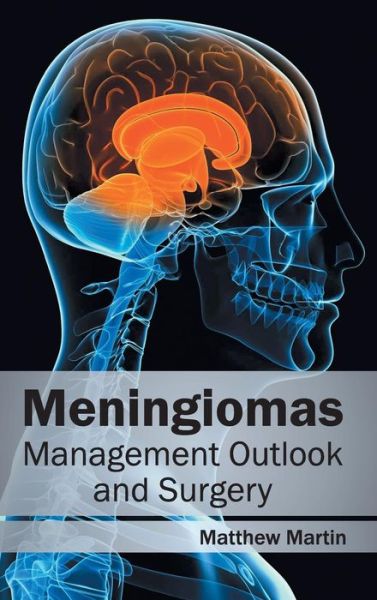 Meningiomas: Management Outlook and Surgery - Martin, Matthew, Etc - Böcker - Hayle Medical - 9781632412775 - 5 mars 2015