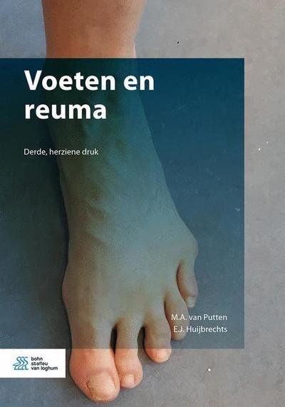 Voeten en reuma - Margreet van Putten - Boeken - Bohn Stafleu van Loghum - 9789036823777 - 3 oktober 2019