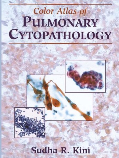 Cover for Sudha R. Kini · Color Atlas of Pulmonary Cytopathology (Paperback Book) [Softcover Reprint of the Original 1st Ed. 2002 edition] (2011)