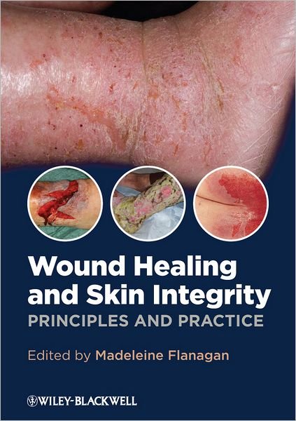 Cover for Flanagan, Madeleine (University of Hertfordshire, UK) · Wound Healing and Skin Integrity: Principles and Practice (Paperback Book) (2013)