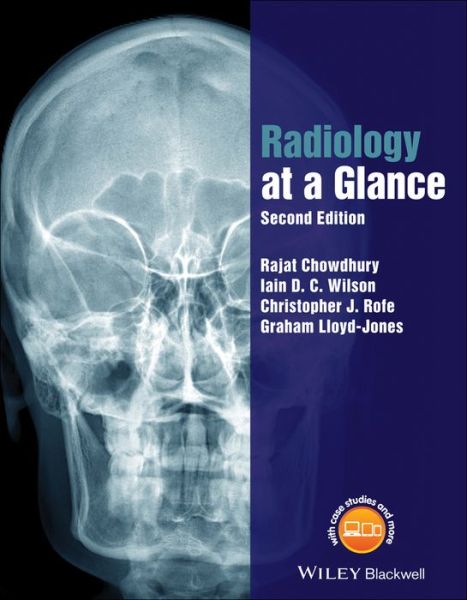 Cover for Chowdhury, Rajat (Southampton General Hospital) · Radiology at a Glance - At a Glance (Paperback Book) (2017)