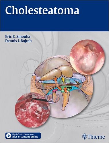 Cholesteatoma - Eric E. Smouha - Boeken - Thieme Medical Publishers Inc - 9781604062779 - 1 november 2011
