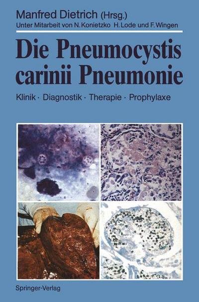 Cover for Manfred Dietrich · Die Pneumocystis Carinii Pneumonie (Taschenbuch) (1989)