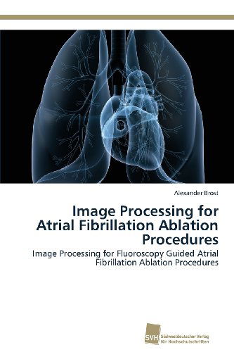 Cover for Alexander Brost · Image Processing for Atrial Fibrillation Ablation Procedures: Image Processing for Fluoroscopy Guided Atrial Fibrillation Ablation Procedures (Paperback Book) (2013)