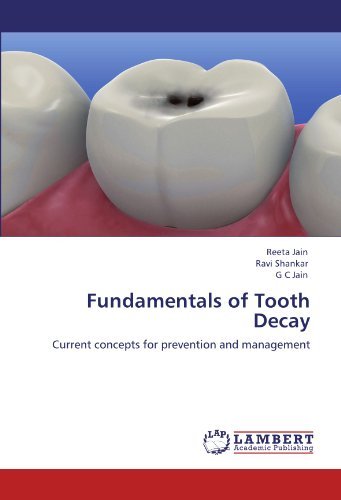 Fundamentals of Tooth Decay: Current Concepts for Prevention and Management - G C  Jain - Książki - LAP LAMBERT Academic Publishing - 9783844387780 - 1 września 2011