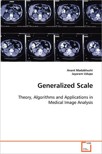 Cover for Jayaram Udupa · Generalized Scale (Paperback Book) (2008)