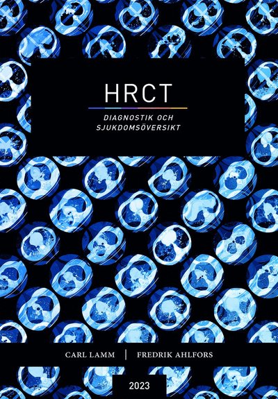 Cover for Carl Lamm · HRCT : diagnostik och sjukdomsöversikt (Book) (2023)