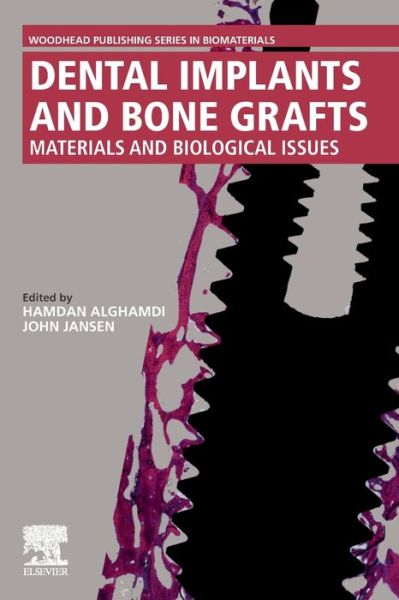Cover for Dental Implants and Bone Grafts: Materials and Biological Issues (Paperback Book) (2019)