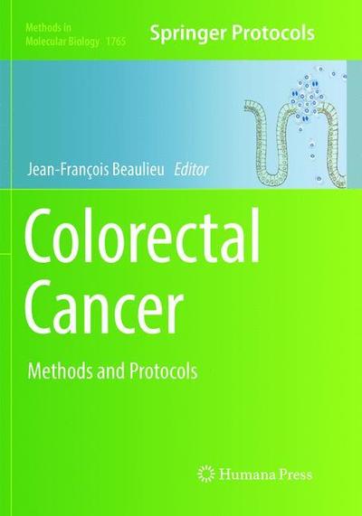 Cover for Colorectal Cancer (Book) [Softcover reprint of the original 1st ed. 2018 edition] (2019)